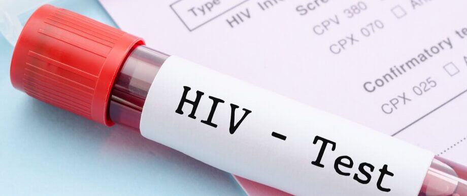 Free HIV testing in Nashville, TN